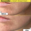 Ceramidin™   Ectoin-Infused Cream 50 ml