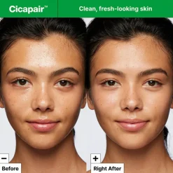Cicapair™   Gentle Cleansing Foam 150 ml
