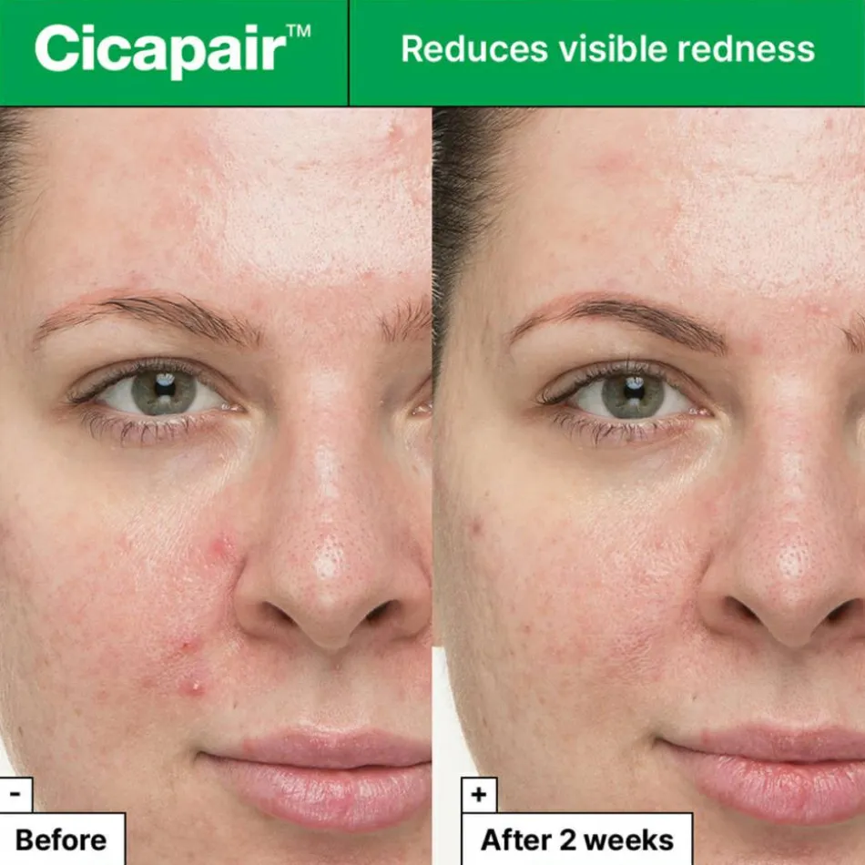 Cicapair™ So Soothing Treatment 30 ml