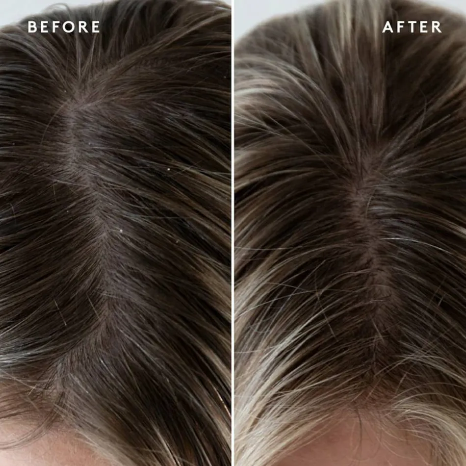 Exfoliating Scalp Treatment 150 ml