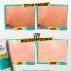 Expertly Clear Blemish-Treating & Preventing Lotion 60 ml