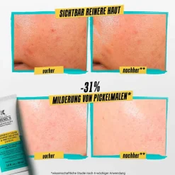 Expertly Clear Blemish-Treating & Preventing Lotion 60 ml