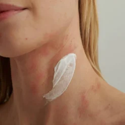 EXTRODERM Intensivcreme 50 ml