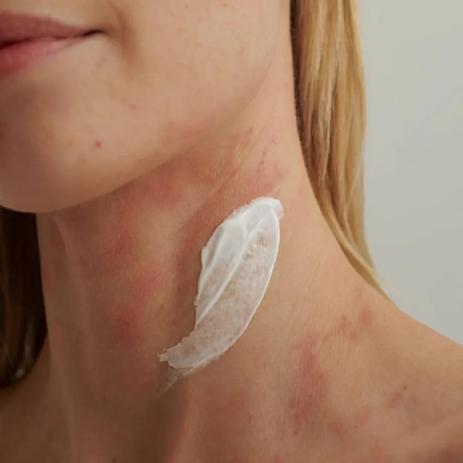 EXTRODERM Intensivcreme 50 ml