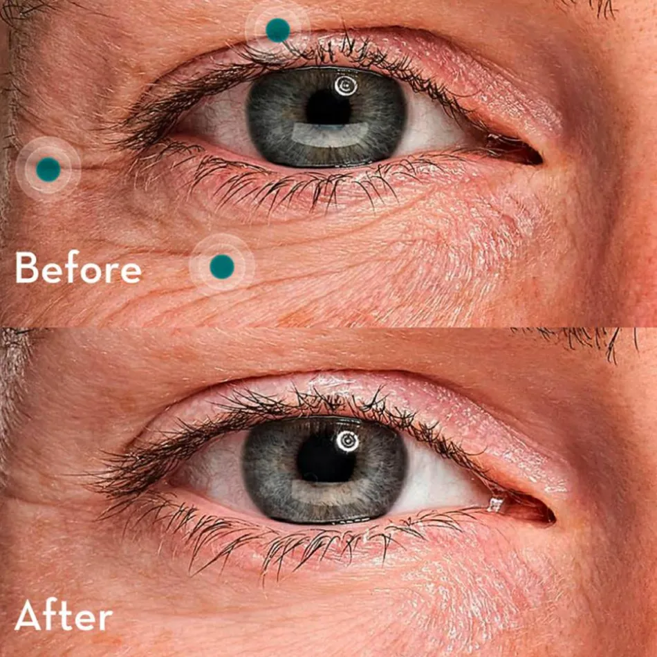 Eye Recipe 20 ml