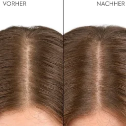 Feuchtigkeitsspendende Kopfhaut Drops 100 ml