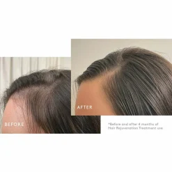 Flourish   Hair Rejuvenation Treatment 1 month supply Set