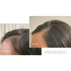 Flourish Hair Rejuvenation Treatment 3 month supply Set