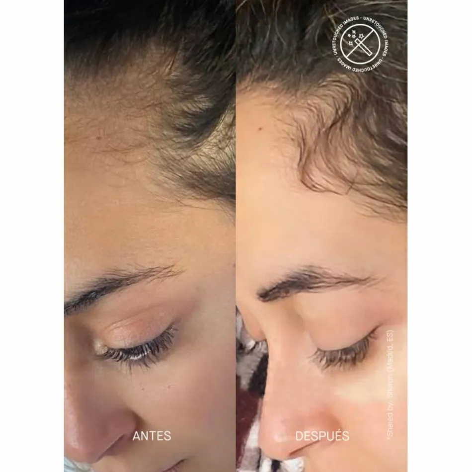 Hair Density Scalp Treatment 50 ml