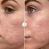 Hyaluronic Acid Hydrating Booster 10 ml