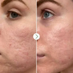 Hyaluronic Acid Hydrating Booster 10 ml