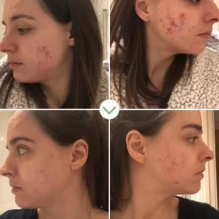 Instant Kalmer Ceramide Serum 30 ml