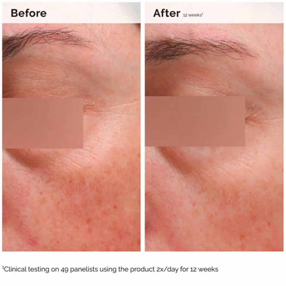 Niacinamide 5% Face & Body Emulsion 100 ml
