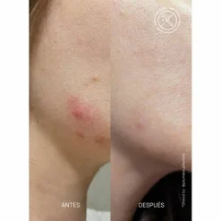 POSTZIT Corrector Serum 30 ml