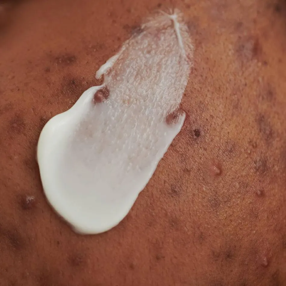 PURDERM Waschcreme 100 ml