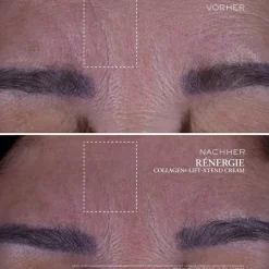 Rénergie   Collagen+ Lift-Xtend Cream 50 ml