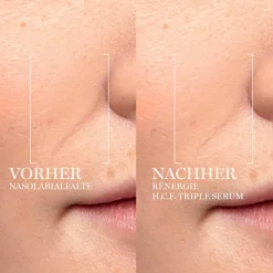 Rénergie    H.C.F. Triple Serum 50 ml