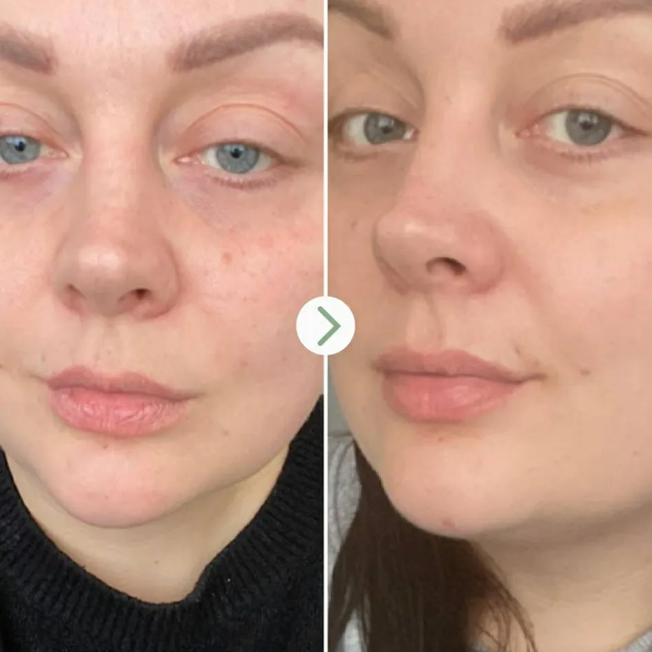 Rosehip Bioregenerate Face Oil 30 ml