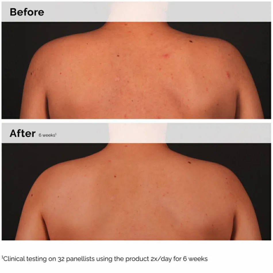 Salicylic Acid 0.5% Body Serum 240 ml