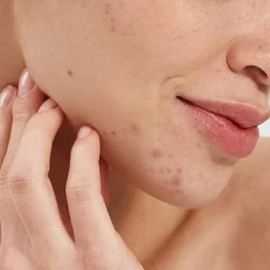 Salicylic Acid Booster 2 % 10 ml