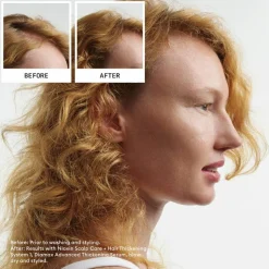 Scalp + Hair System 1  Haarpflegesystem-Kit