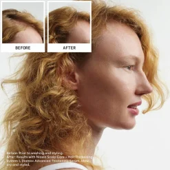 Scalp + Hair System 1  Treatment 100 ml