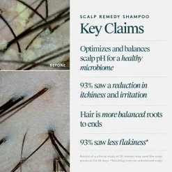 Scalp Remedy   Shampoo 240 ml