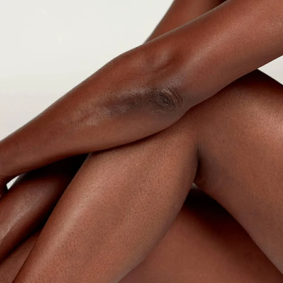 The Gemini Stretch Mark System