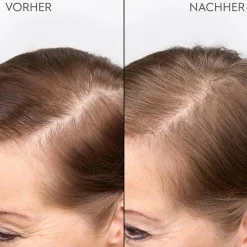 Verdichtendes Kopfhaut Serum 100 ml