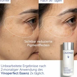 Vinoperfect   Essenz mit Glykolsäure 100 ml
