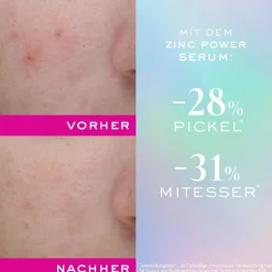 Zinc Power Serum 30 ml